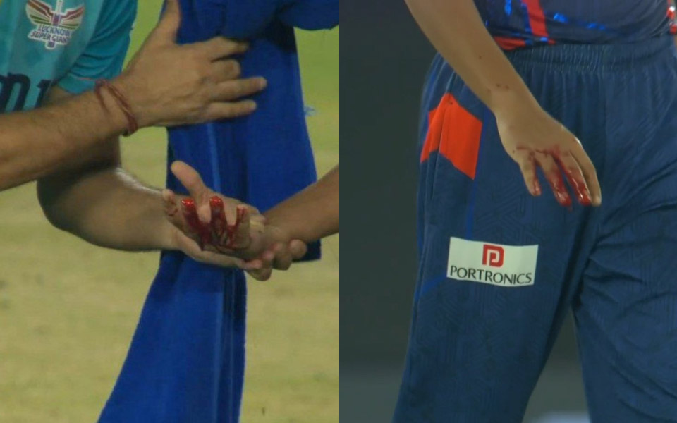 IPL 2025: Shubman Gill’s fierce strike hits Akash Singh, suffers heavy bleeding